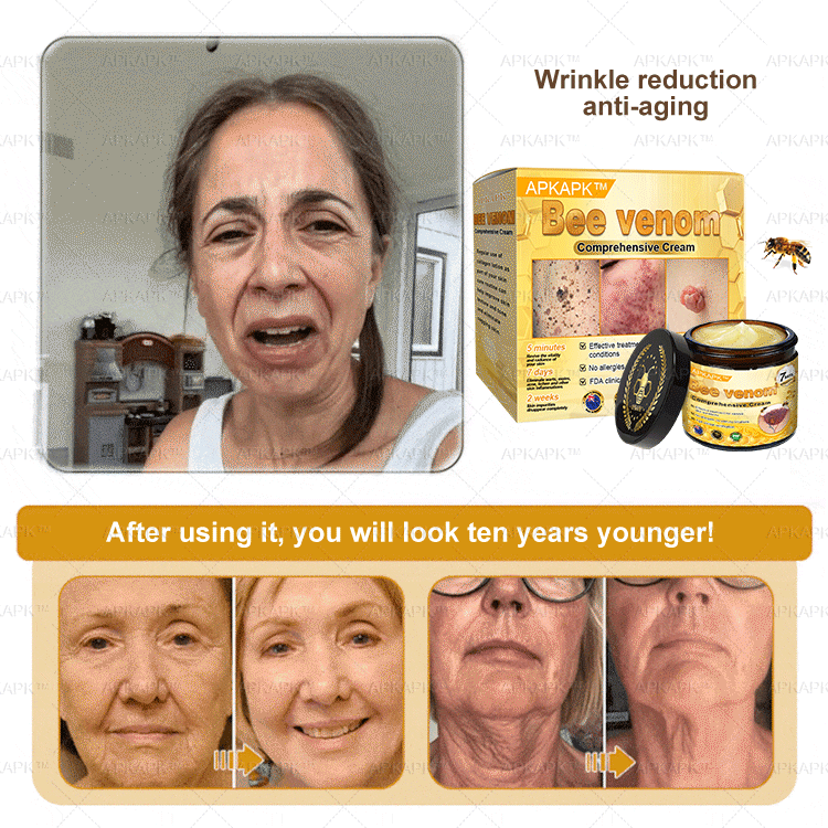 APKAPK⢠Bee Venom Skin Treatment Cream, Anti-aging, Hydrating, Skin Repair, Even Tone, Acne and Dark Spot Treatment, Wart and Mole Removal, Psoriasis Relief
