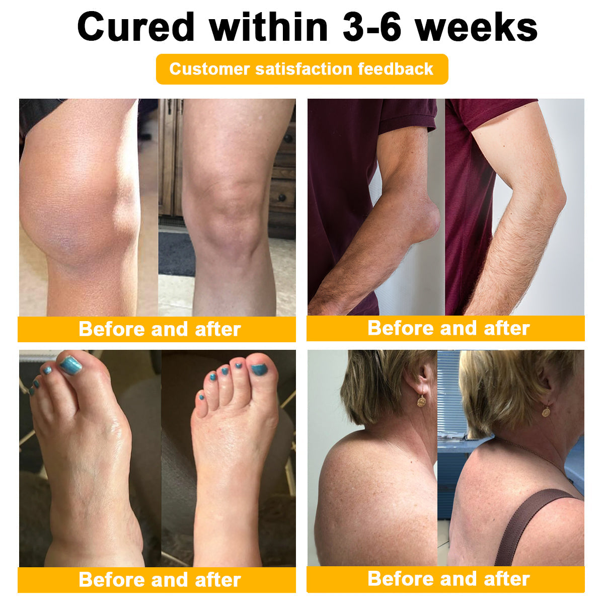 👑👑LIPOGO™ Bee Venom & Turmeric Arthritis Treatment Cream (👩🔬Specialized in Orthopedic Conditions and Joint Pain👩🔬)