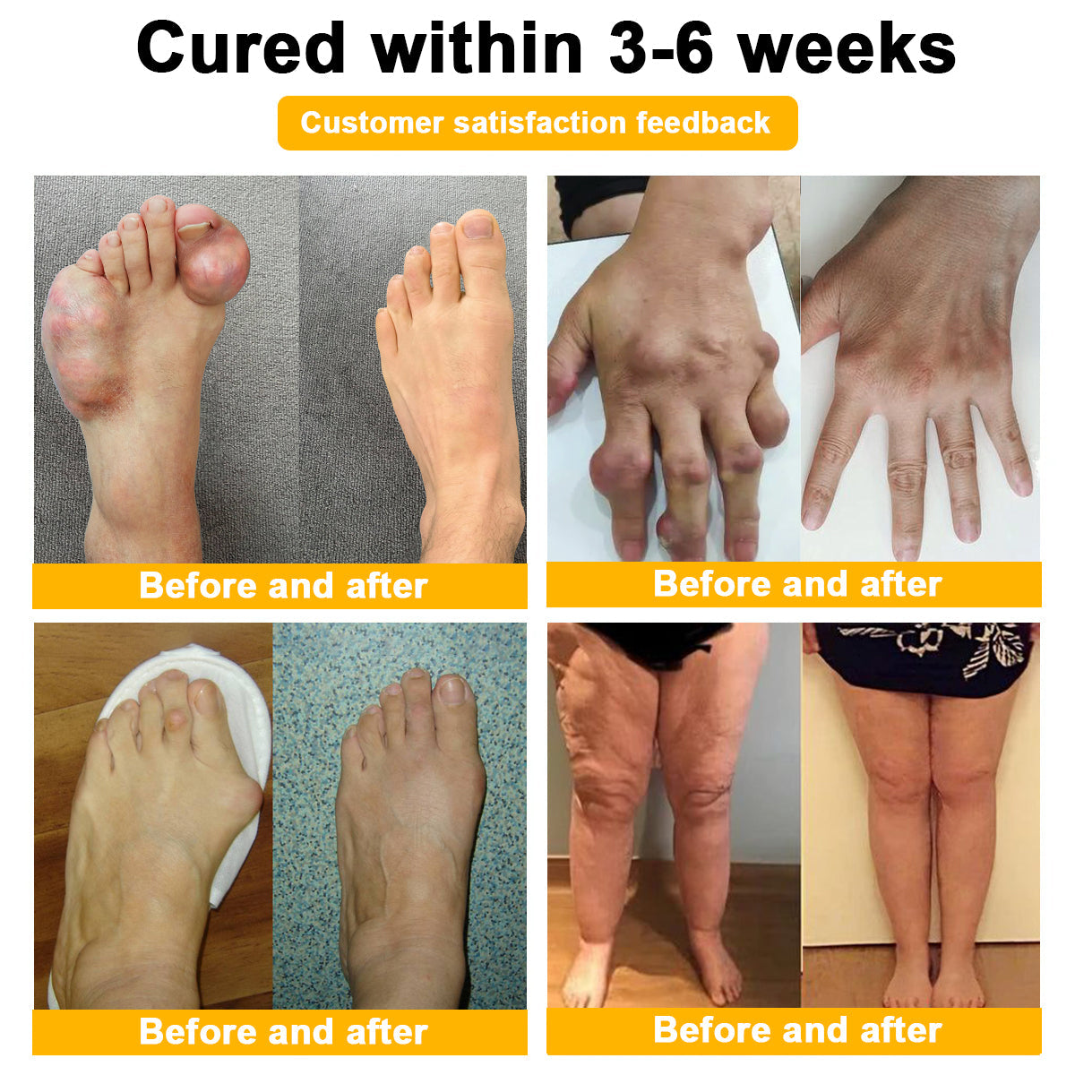 👑👑LIPOGO™ Bee Venom & Turmeric Arthritis Treatment Cream (👩🔬Specialized in Orthopedic Conditions and Joint Pain👩🔬)