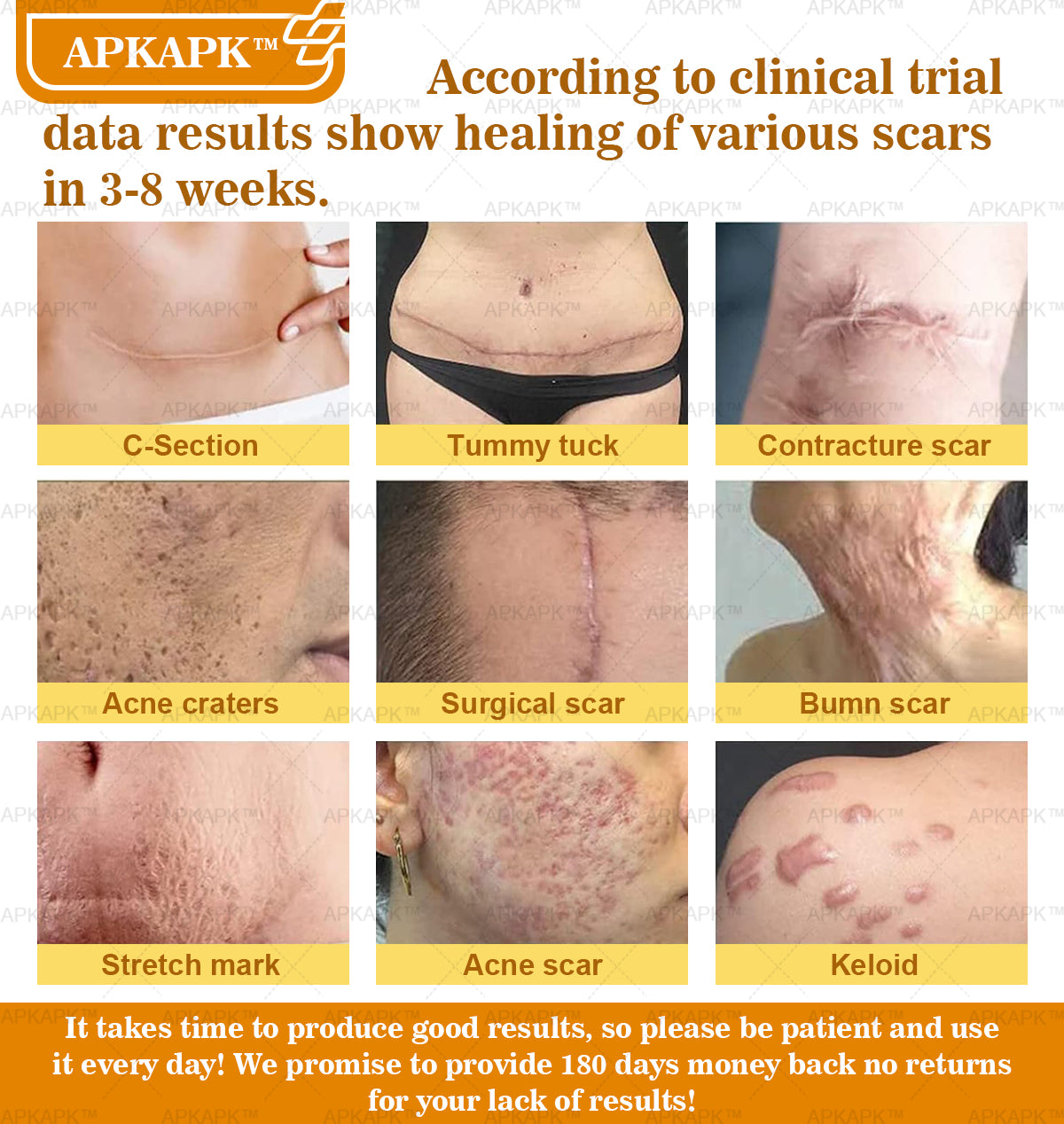 APKAPK⢠Bee Venom Skin Treatment Cream, Anti-aging, Hydrating, Skin Repair, Even Tone, Acne and Dark Spot Treatment, Wart and Mole Removal, Psoriasis Relief