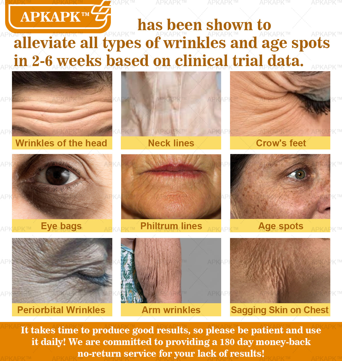 APKAPK⢠Bee Venom Skin Treatment Cream, Anti-aging, Hydrating, Skin Repair, Even Tone, Acne and Dark Spot Treatment, Wart and Mole Removal, Psoriasis Relief