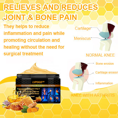 👑👑LIPOGO™ Bee Venom & Turmeric Arthritis Treatment Cream (👩🔬Specialized in Orthopedic Conditions and Joint Pain👩🔬)