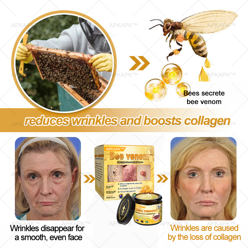 APKAPK⢠Bee Venom Skin Treatment Cream, Anti-aging, Hydrating, Skin Repair, Even Tone, Acne and Dark Spot Treatment, Wart and Mole Removal, Psoriasis Relief