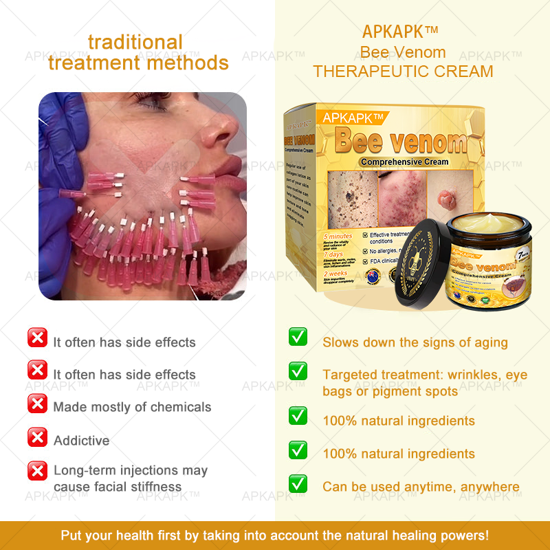APKAPK⢠Bee Venom Skin Treatment Cream, Anti-aging, Hydrating, Skin Repair, Even Tone, Acne and Dark Spot Treatment, Wart and Mole Removal, Psoriasis Relief