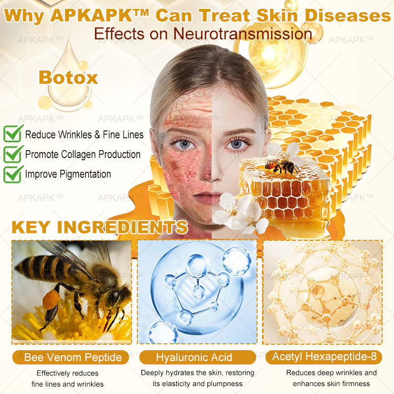 APKAPK⢠Bee Venom Skin Treatment Cream, Anti-aging, Hydrating, Skin Repair, Even Tone, Acne and Dark Spot Treatment, Wart and Mole Removal, Psoriasis Relief