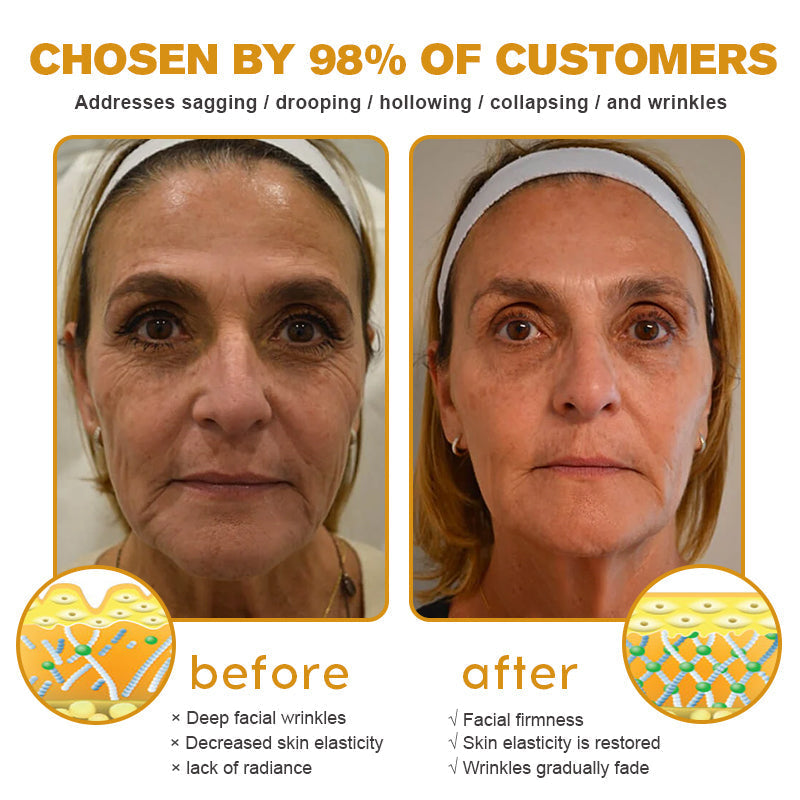 APKAPK⢠Bee Venom Skin Treatment Cream, Anti-aging, Hydrating, Skin Repair, Even Tone, Acne and Dark Spot Treatment, Wart and Mole Removal, Psoriasis Relief