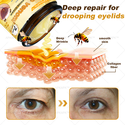 APKAPK™ Bee Venom Skin Treatment Cream, Anti-aging, Hydrating, Skin Repair, Even Tone, Acne and Dark Spot Treatment, Wart and Mole Removal, Psoriasis Relief