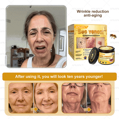 APKAPK™ Bee Venom Skin Treatment Cream, Anti-aging, Hydrating, Skin Repair, Even Tone, Acne and Dark Spot Treatment, Wart and Mole Removal, Psoriasis Relief