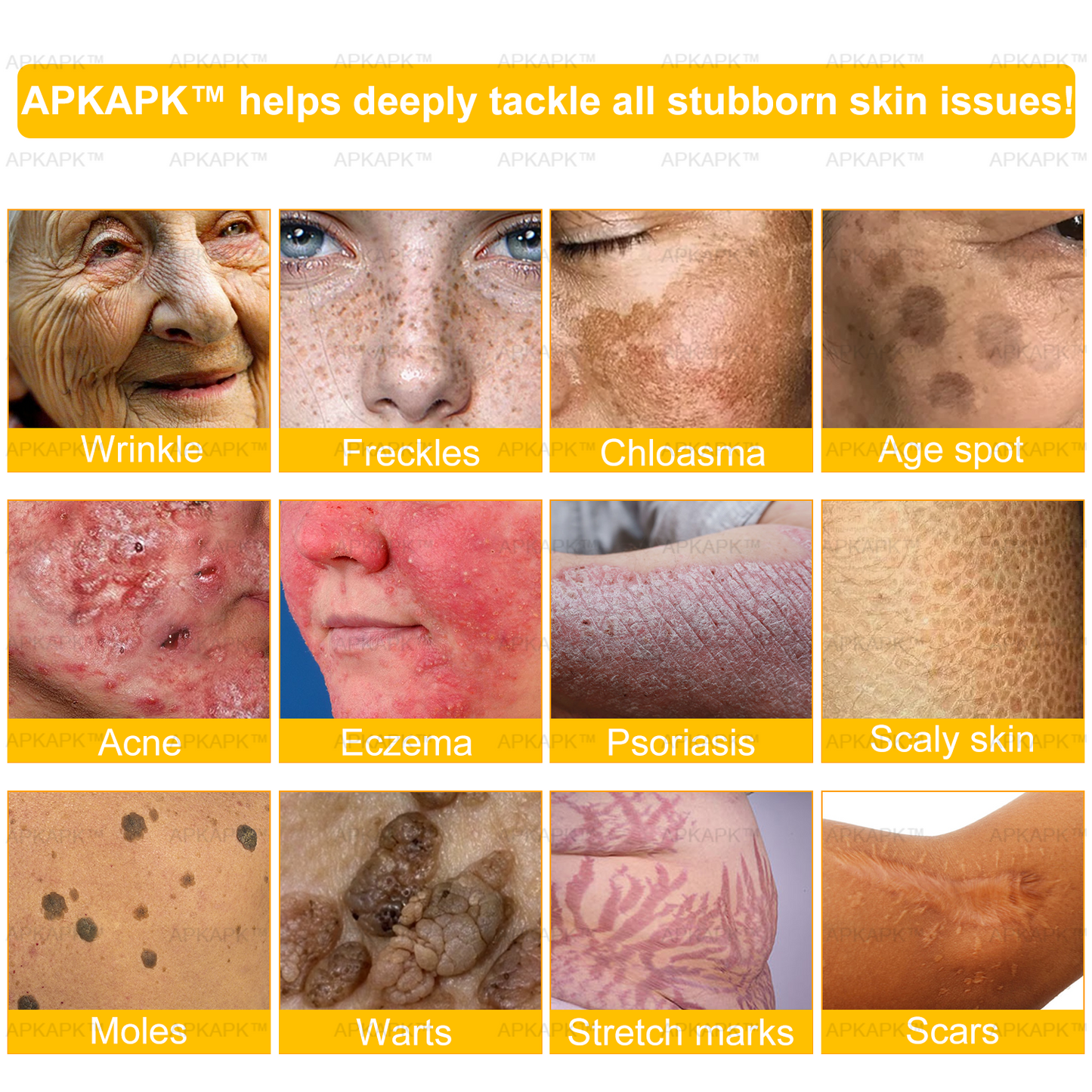 𝐀𝐏𝐊𝐀𝐏𝐊™ Bee Venom Comprehensive Cream (Suitable for all ages & TGA recommends)🔥🔥
