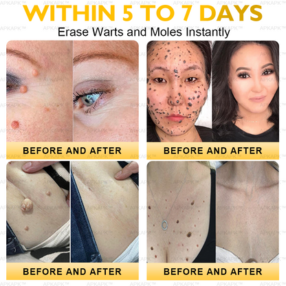 𝐀𝐏𝐊𝐀𝐏𝐊™ Bee Venom Comprehensive Cream (Suitable for all ages & TGA recommends)🔥🔥