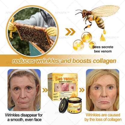 APKAPK™ Bee Venom Skin Treatment Cream, Anti-aging, Hydrating, Skin Repair, Even Tone, Acne and Dark Spot Treatment, Wart and Mole Removal, Psoriasis Relief