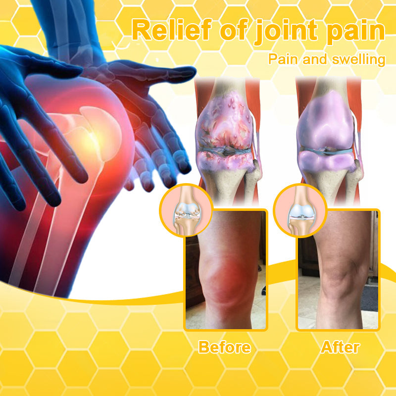 👑👑LIPOGO™ Bee Venom & Turmeric Arthritis Treatment Cream (👩‍🔬Specialized in Orthopedic Conditions and Joint Pain👩‍🔬)