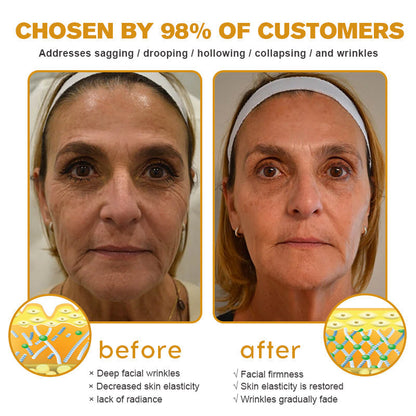 APKAPK™ Bee Venom Skin Treatment Cream, Anti-aging, Hydrating, Skin Repair, Even Tone, Acne and Dark Spot Treatment, Wart and Mole Removal, Psoriasis Relief